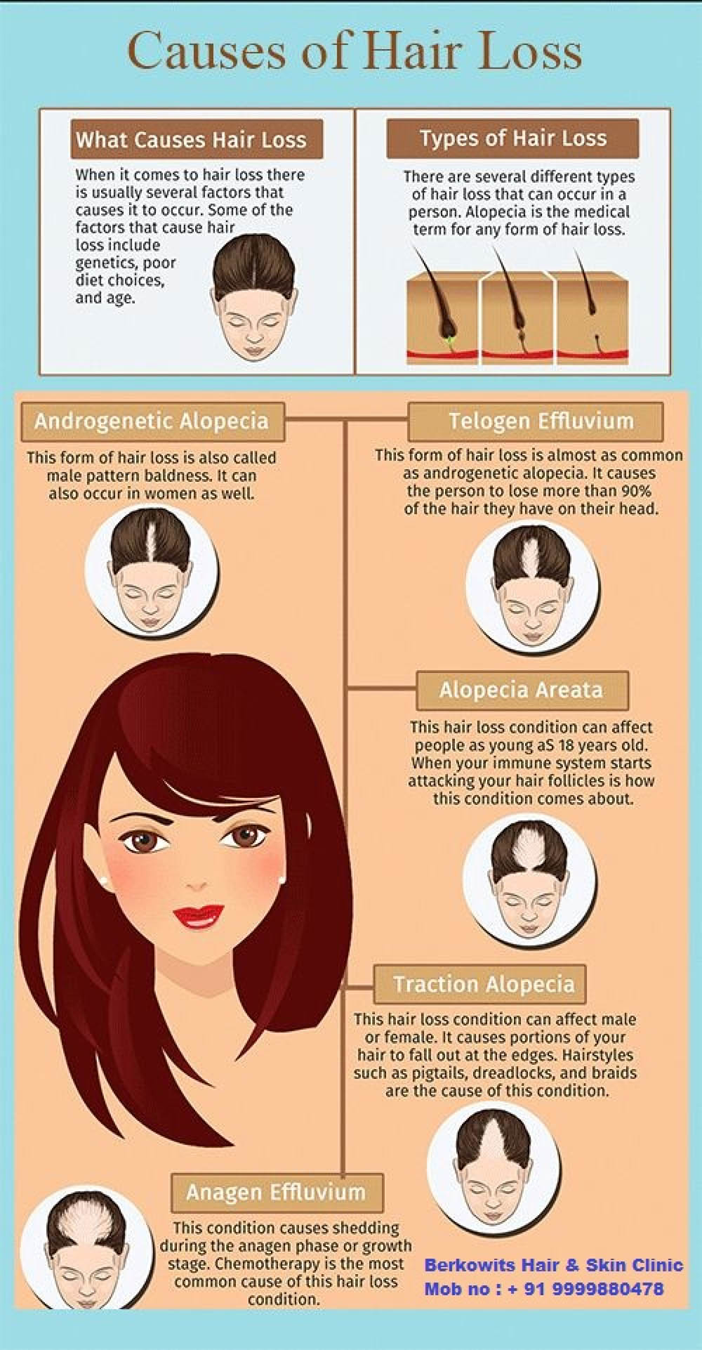 Causes Of Hair Loss Infographic Infographics