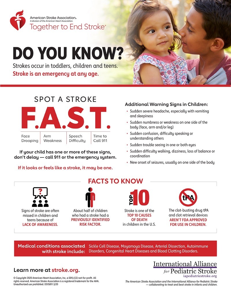 presentation of pediatric stroke