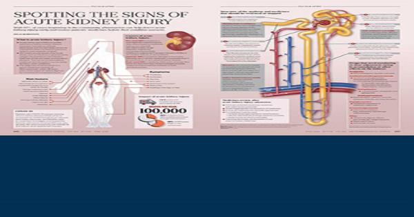 Spotting The Signs Of Acute Kidney Injury Infographics