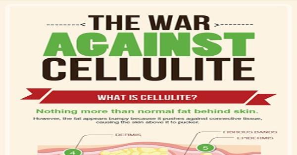 The War Against Cellulite Infographic Infographics | Medicpresents.com