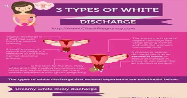 3 Types of White Vaginal Discharge Infographic