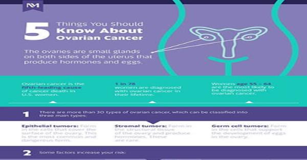 5 Things To Know About Ovarian Cancer Infographic Infographics
