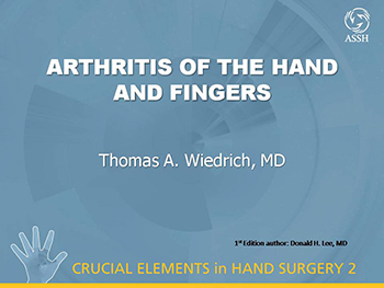 Hand And Finger Arthritis Nmh