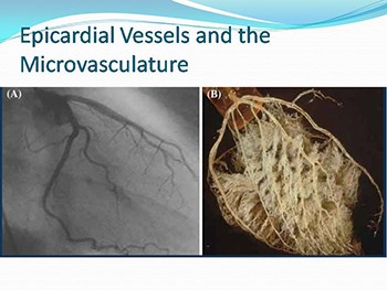 Coronary blood flow reserve