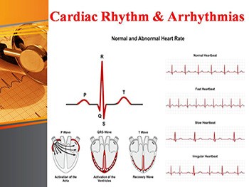 Antiarrhythmic drugs