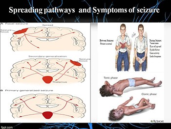 Anti-Seizure Drugs