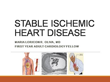 stable ischemic heart disease