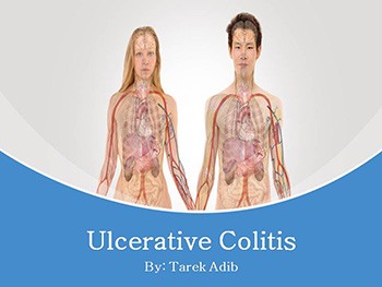 Ulcerative Colitis