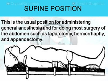 Surgical Positions