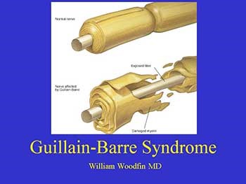 About Guillain Barre Syndrome