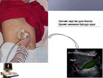 Diagnosis of Abdominal Ultrasound