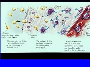 Hypersensitivity Disorders Allergic Emergencies