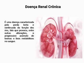 Kidney article