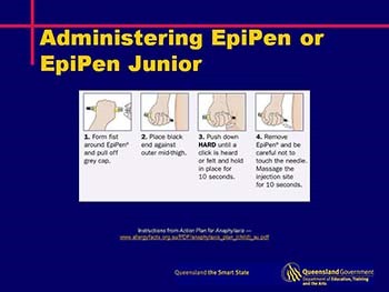 Management and treatment of students with anaphylaxis