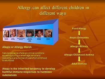 Allergic Rhinitis and co-morbidities in children