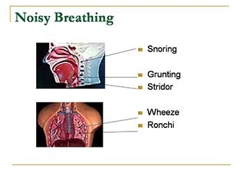 An approach to a child with respiratory symptoms