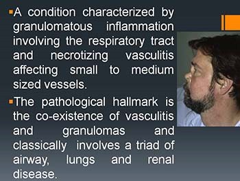 Chronic granulomatous conditions of nose