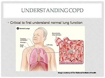 COPD - Chronic Obstructive Pulmonary Disease