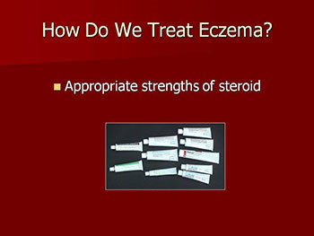 The Treatment And Management of Eczema