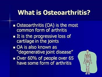 Medications for Osteoarthritis - Relieving the Pain