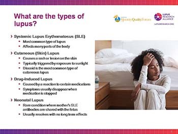 Lupus: Get the Facts
