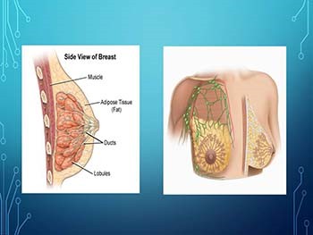 Screening for Breast cancer