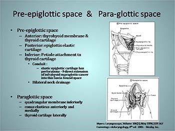 Malignant Lesions of the Larynx