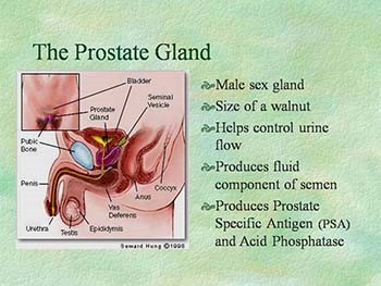 Possible Loci Linked to Prostate Cancer