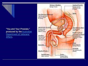 Prostate Cancer