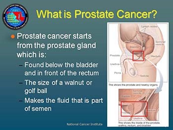 Prostate Cancer: Education and Outreach