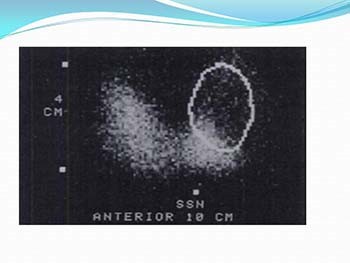 Approach to a Case of Thyroid Nodule