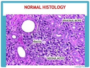 Diseases of salivary gland