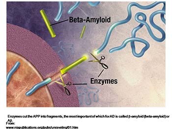 Disorders with Complex Genetics - Alzheimers Disease