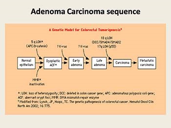 Benign And Malignant Tumors Of The Rectum