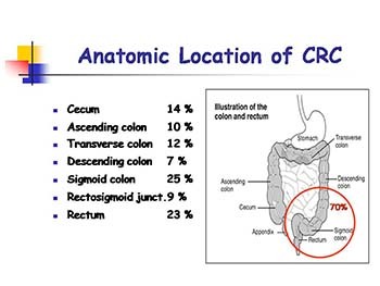 Gastrointestinal Cancer