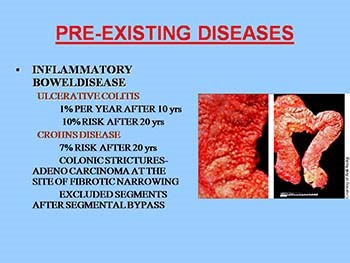 Carcinoma Rectum