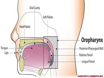 HPV and Oropharyngeal Cancer