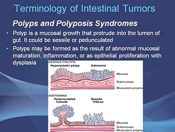 Tumors of the small and large intestines