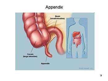 Appendix and Appendicitis