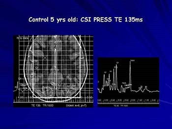 Imaging Brain Tumors in Newborns and Early Childhood: Utility of Combining MR Techniques