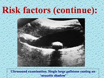 Incidental Gallbladder Cancer