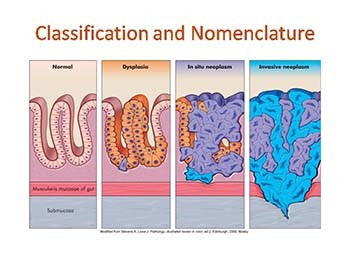 Cell Proliferation: Cancer