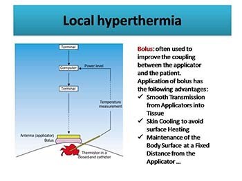 Local Hyperthermia