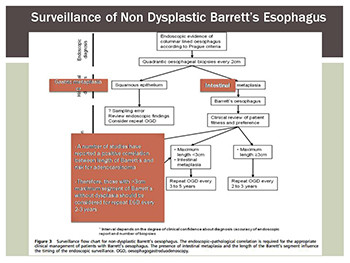 Barretts Esophagus