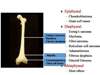 Orthopaedic Pathological Specimen and Histology