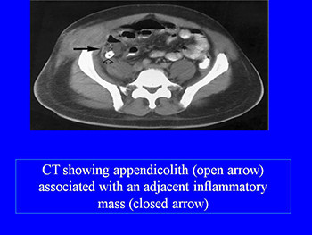 G I Radiology Potpourri