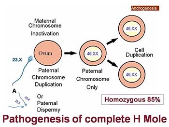 Gestational Trophoblastic Disease - GTD