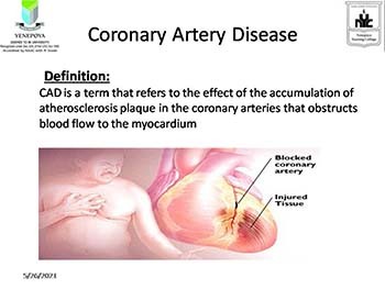 Coronary Artery Disease