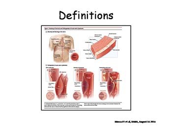 Acute Aortic Syndrome