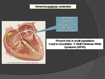 Antiarrhythmic drugs